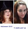 my face weight loss.jpg